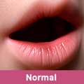 Normal
